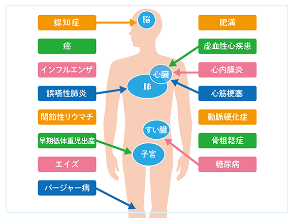 リスクが高まる主な疾患